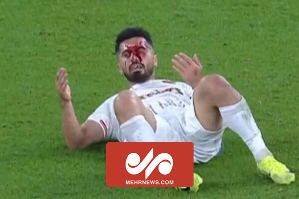 لحظه برخورد امید عالیشاه با بازیکن الریان - خبرگزاری مهر | اخبار ایران و جهان