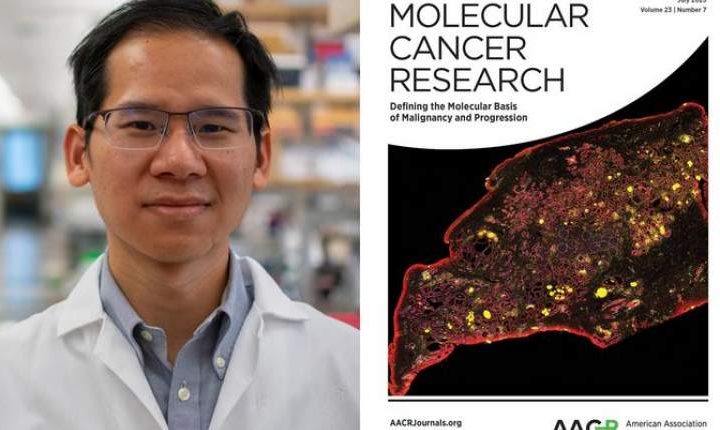 سلول‌های جاسوس و همدست خاموش سرطان پروستات شناسایی شدند
