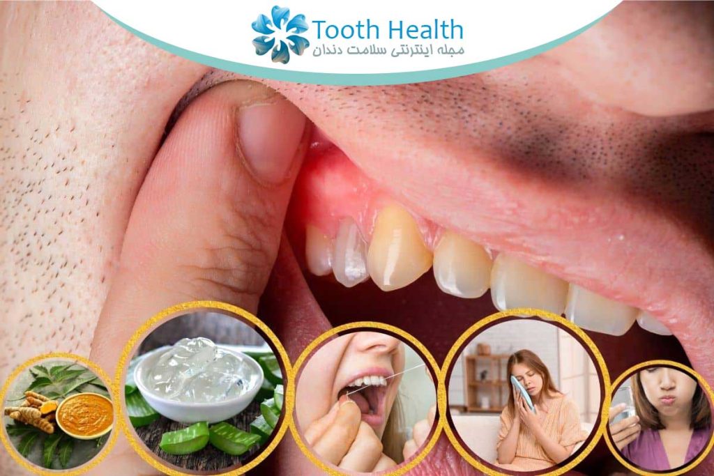 لبخندی که همه چیز رو تغییر میده؛ راهنمای کامل مراقبت و درمان های دندانپزشکی 11 لبخندی که همه چیز رو تغییر میده؛ راهنمای کامل مراقبت و درمان های دندانپزشکی