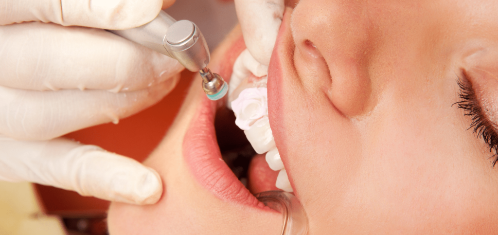 لبخندی که همه چیز رو تغییر میده؛ راهنمای کامل مراقبت و درمان های دندانپزشکی 13 لبخندی که همه چیز رو تغییر میده؛ راهنمای کامل مراقبت و درمان های دندانپزشکی